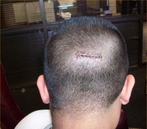 RG_8staples
