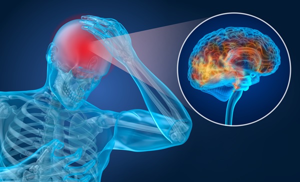 Graphic of a skeleton holding head in pain from to indicate a brain injury